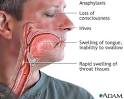 Anaphylaxis: MedlinePlus Medical Encyclopedia Image