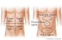 <b>Abdominal Pain</b>