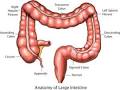 Colon Cleanse - Complete System to Lose Deadly Toxins