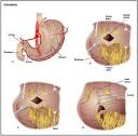 Helicobacter Pylori Infections photos