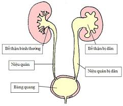 http://images.google.com/imgres?q=tháº­n&hl=en&biw=1280&bih=633&tbm=isch&tbnid=fmDn2gXcxlZbMM:&imgrefurl=http://www.ycantho.com/qa/showthread.php?7125-Ph%C3%A2n-%C4%91%E1%BB%99-%E1%BB%A9-N%C6%B0%E1%BB%9Bc-C%E1%BB%A7a-Th%E1%BA%ADn-(NH%C3%93M-3-PD-PK)&docid=GMsOfe76OV7AEM&imgurl=http://www.nhidong.org.vn/Data_Nhidong1/1332/Untitled-1.jpg&w=371&h=319&ei=t6ExUOCDJ-SMyAHwjYDQCg&zoom=1&iact=hc&vpx=305&vpy=285&dur=2384&hovh=208&hovw=242&tx=104&ty=92&sig=107332654736026722536&page=1&tbnh=130&tbnw=151&start=0&ndsp=19&ved=1t:429,r:7,s:0,i:97