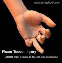 <b>Injuries</b>. DIP Flexor <b>Tendon</b>