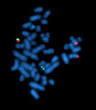Cytogenetics - Wikipedia, the free encyclopedia