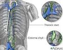 b. <b>thoracic duct</b>