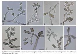Image result for Cladosporium herbarum var. phlei