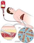 <b>Blood Transfusion</b> Fundamentals