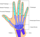 Bone Spur Hand