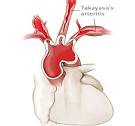 <b>Takayasu's Arteritis</b> Causes