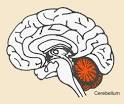 Neuroskeptic: Boy Without A Cerebellum...Has No Cerebellum