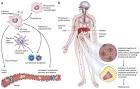 Crimean-Congo Hemorrhagic Fever Virus | Humen Healths