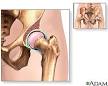 Illustration of the <b>hip</b> joint
