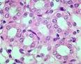 Simple cuboidal <b>epithelium</b>