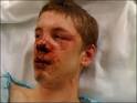 ANU News.net black on white crime