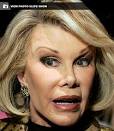 Which celebrity had the worst plastic surgery    In Your Face