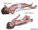 Most convulsions in young