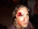 Police Grenade Occupy Oakland Protestors Trying To Help ...