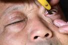 From the OMG WTF Files – The Ancient Art of EYEBALL SHAVING | Jim ...