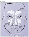 Sinus Headaches: Symptoms and Treatment