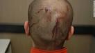 Police: Trayvon Martin's death 'ultimately avoidable' - CNN.
