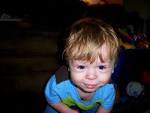 Day 2 of Williams Syndrome