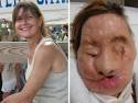 Carla Nash vor und nach der