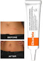 <b>Cicatrix</b> - Advanced gel for