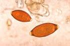 File:Eggs of <b>Trichuris</b>