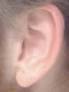 Earlobe - Wikipedia, the free encyclopedia