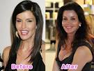 Fresh Pics  16 Worst Celebrity Plastic Surgery Disasters