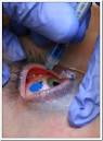 Eyeball Tattoo