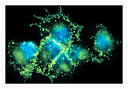 Endogenous alkaline phosphatase activity of osteosarcoma cells ...