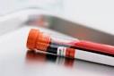 The phlebotomist is an