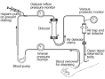 dialysis.gif