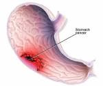 Maddy // <b>Stomach Diseases</b>
