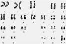 chromosome: Definition from Answers.