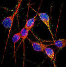 Researchers Induce Alzheimer's Neurons From Pluripotent Stem Cells
