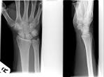 The <b>Wrist</b>