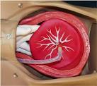 Manual <b>Placenta</b> Removal News, Information, Videos, Images