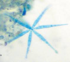 Image result for Dendrospora juncicola