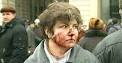 A woman with blood on her face
