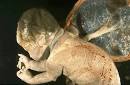 Placental Pathology