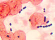 Enterococcus - Wikipedia, the free encyclopedia