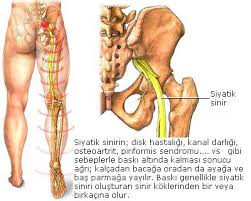 Bel Fıtığı Belirtileri