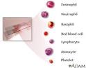 Complete Blood Count (CBC) Normal Laboratory Study Values ...