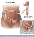 Mayo Clinic medical information and tools for healthy living ...