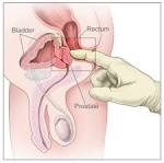 File:Digital rectal exam nci-vol-7136-300.jpg - Wikipedia, the ...