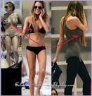 toothincelebs
