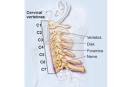Pain (<b>Cervicalgia</b>) - South