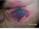MSKTC | Deep Tissue