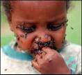 What does <b>Eye Disease</b> look